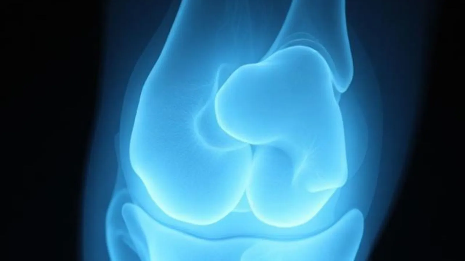 knee xray joke